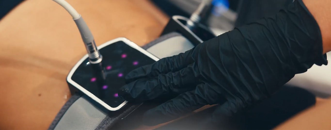 Tratamento da flacidez muscular e tissular com Radiofrequência e ondas eletromagnética com Transform X