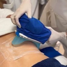 coolscupting-300x300